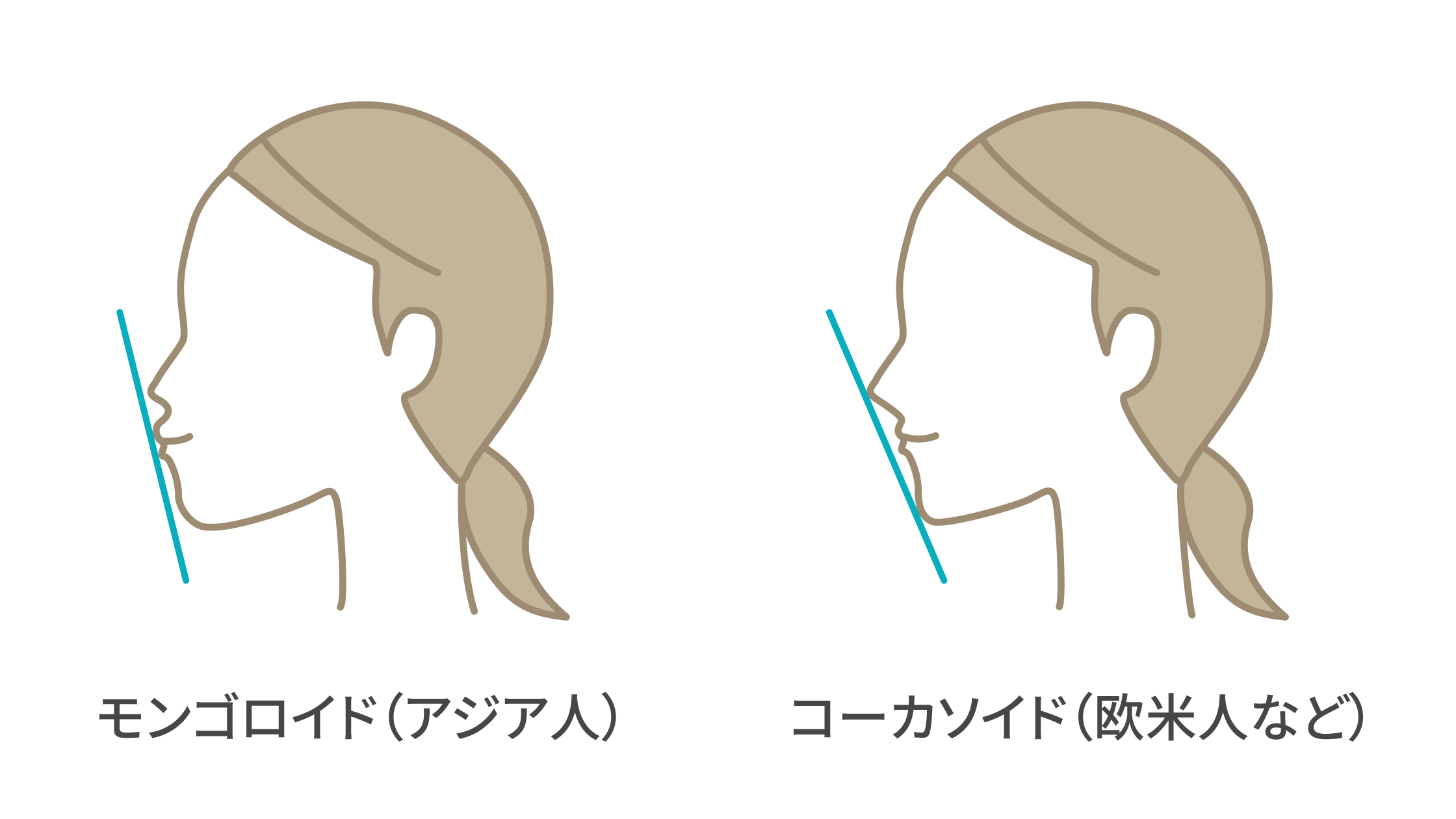 切らない“セットバック矯正”でEラインを整え憧れの横顔美人に