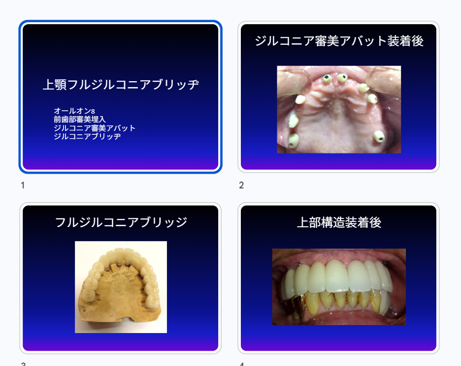 上顎フルジルコニアブリッジ症例
